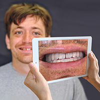 Person using an iPad to visualise the outcome of dental treatment